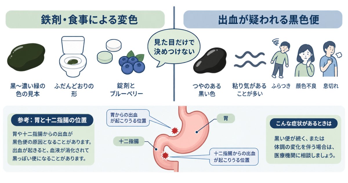 鉄剤による黒い便と、出血が疑われる便の見方